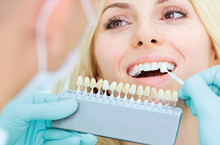 Desmistificando o clareamento dental